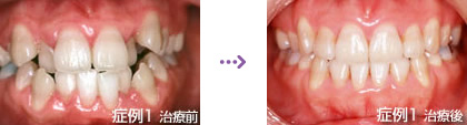 症例１