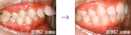 症例２