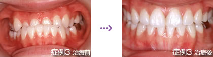 症例３