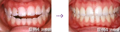 症例４